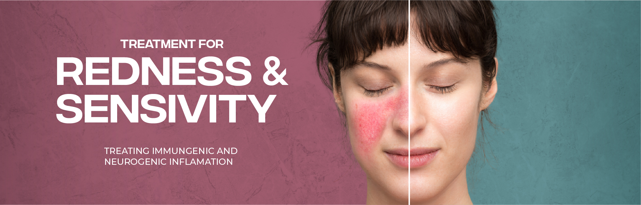 Redness Sensitivity Yec Clinic