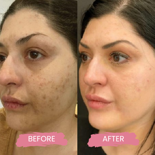 Secret PRO Ultra-Light 1