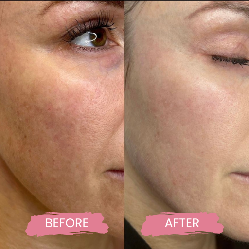 Secret PRO Ultra-Light 2