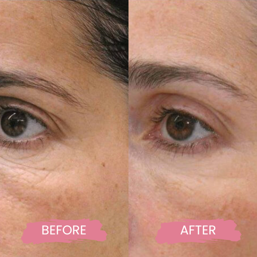 Secret PRO Ultra-Light 3 (1)