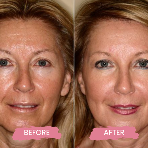 Secret PRO Ultra-Light 3 (2)