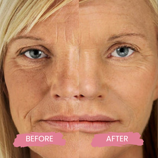 Secret PRO Ultra-Light 3