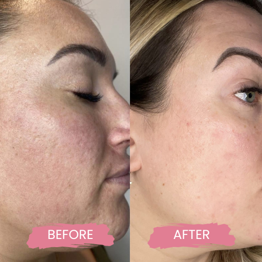 Secret PRO Ultra-Light 3