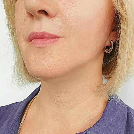 Secret PRO Ultra-Light a