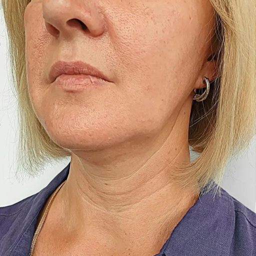 Secret PRO Ultra-Light b Secret PRO Ultra-Light b