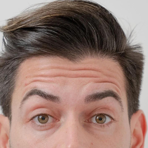 Anti wrinkle injection b Anti wrinkle injection b