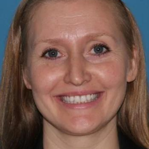 DERMAL FILLERS b DERMAL FILLERS b