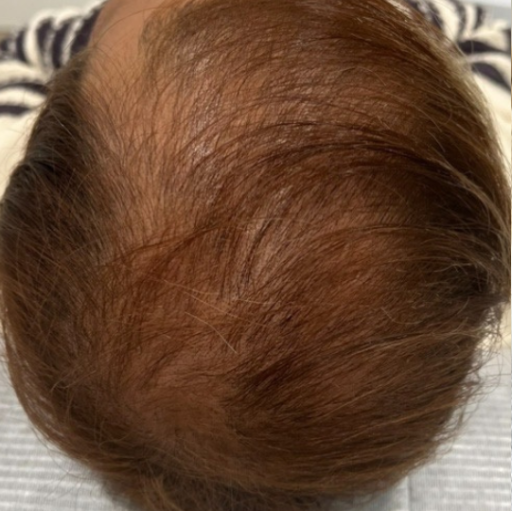 HAIR FILLERS b HAIR FILLERS b