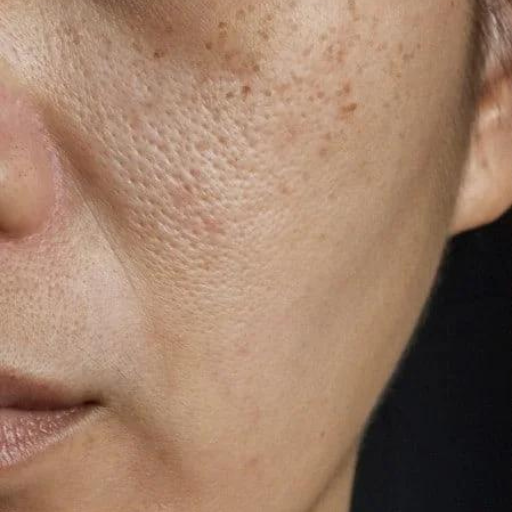 IV CINDERELLA WHITENING SET b IV CINDERELLA WHITENING SET b