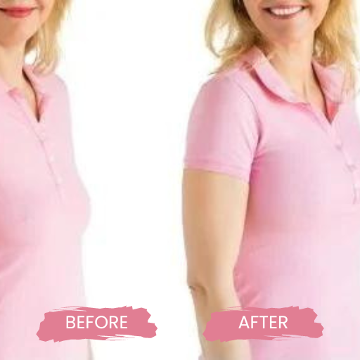 Non surgical BBL & BREAST LIFT 1