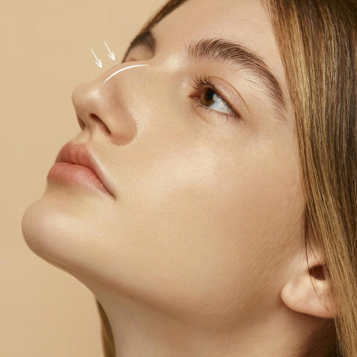 Nose Threads b Nose Threads b