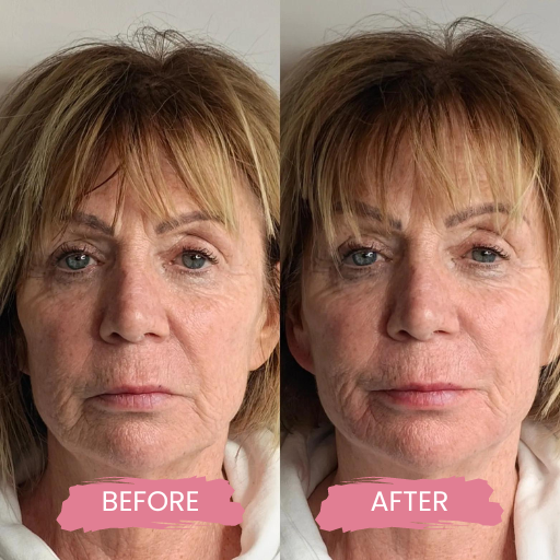 PDO AND COG THREADS 1