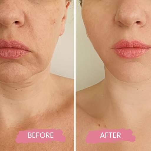 PDO AND COG THREADS 3