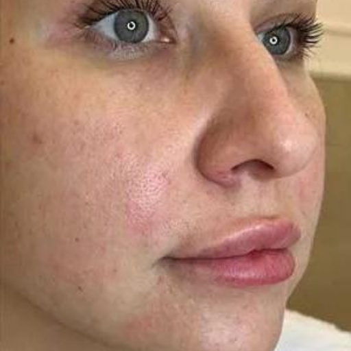 PDO AND COG THREADS a