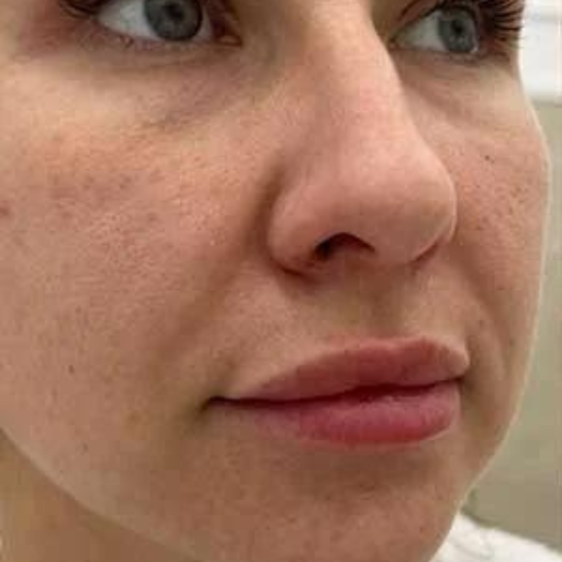 PDO AND COG THREADS b PDO AND COG THREADS b