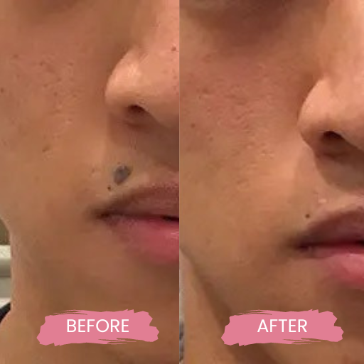 Secret PRO Ultra-Light 3