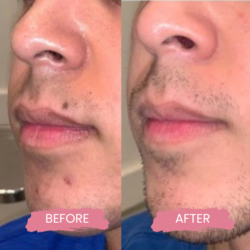 Secret PRO Ultra-Light 3 (2)