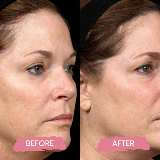 Secret PRO Ultra-Light 3 (2)