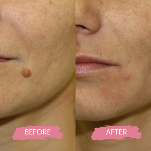 Secret PRO Ultra-Light 3 (3)