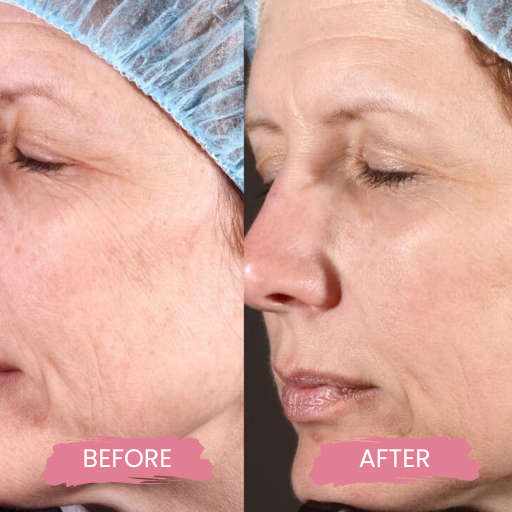 Secret PRO Ultra-Light 3 (3)