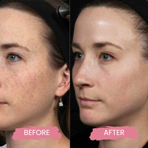 Secret PRO Ultra-Light 3